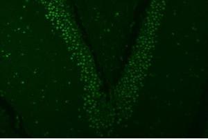 IF analysis of SNRPA1 using anti-SNRPA1 antibody (ABIN7599131).