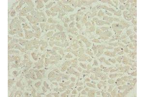 Immunohistochemistry of paraffin-embedded human heart tissue using ABIN7146448 at dilution of 1:100 (CAMK2D 抗体  (AA 1-260))