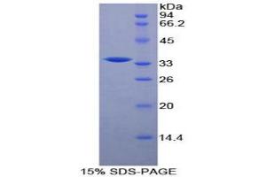 SDS-PAGE analysis of Mouse Raft Linking Protein. (RFTN1 蛋白)