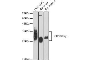 Western blot analysis of extracts of various cell lines, using CD90/Thy1 antibody (ABIN6129735, ABIN6148554, ABIN6148555 and ABIN7101405) at 1:1000 dilution. (CD90 抗体)
