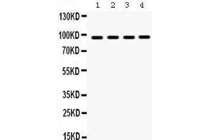 Western Blotting (WB) image for anti-Heat Shock Protein 90kDa beta (Grp94), Member 1 (HSP90B1) (AA 43-221) antibody (ABIN3042463)