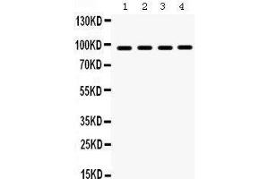 Western Blotting (WB) image for anti-Heat Shock Protein 90kDa beta (Grp94), Member 1 (HSP90B1) (AA 43-221) antibody (ABIN3042463) (GRP94 抗体  (AA 43-221))