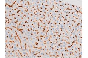 ABIN6267575 at 1/200 staining Mouse liver tissue sections by IHC-P. (SMAD3 抗体  (pSer213))
