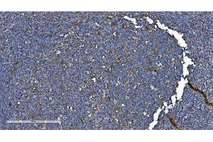 IHC analysis of PNPT1 using anti-PNPT1 antibody (ABIN7599172).