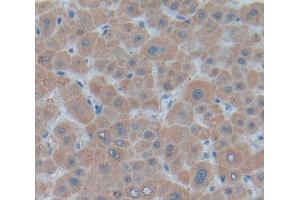 Used in DAB staining on fromalin fixed paraffin- embedded Kidney tissue (UQCRB 抗体  (AA 2-111))