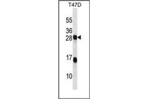 Western blot analysis of KDELR2 Antibody (C-term) in T47D cell line lysates (35ug/lane). (KDELR2 抗体  (C-Term))