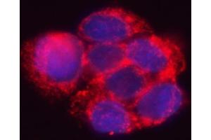 IF analysis of HSD17B7 using anti-HSD17B7 antibody (ABIN7600174).