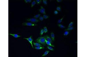 Immunofluorescent analysis of HepG2 cells using ABIN7173221 at dilution of 1:100 and Alexa Fluor 488-congugated AffiniPure Goat Anti-Rabbit IgG(H+L) (TMEM44 抗体  (AA 269-439))