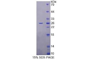 SDS-PAGE analysis of Rat RBP3 Protein. (RBP3 蛋白)