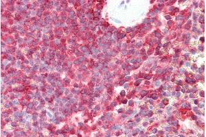 Immunohistochemistry (IHC) image for anti-Proteasome (Prosome, Macropain) Subunit, beta Type, 8 (Large Multifunctional Peptidase 7) (PSMB8) (C-Term) antibody (ABIN571001)