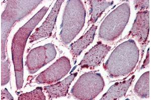 Skeletal muscle, Human: Formalin-Fixed, Paraffin-Embedded (FFPE) (NEK7 抗体  (N-Term))