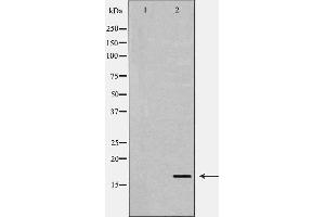 Western blot analysis of Hela  lysate using TGFA antibody. (TGFA 抗体  (C-Term))