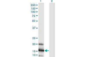 Western Blot analysis of LOC402176 expression in transfected 293T cell line by LOC402176 monoclonal antibody (M03), clone 3E7. (RPL21P44 抗体  (AA 1-136))
