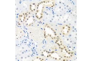 Immunohistochemistry of paraffin-embedded rat kidney using THOC1 antibody (ABIN5974800) at dilution of 1/100 (40x lens). (THOC1 抗体)