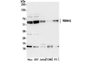anti-RNA Binding Motif Protein 42 (RBM42) (AA 100-150) antibody