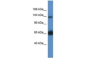 WB Suggested Anti-Rapgef2 Antibody   Titration: 1. (RAPGEF2 抗体  (Middle Region))