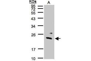 WB Image Sample(30 μg of whole cell lysate) A:293T 12% SDS PAGE antibody diluted at 1:1000 (GUK1 抗体)
