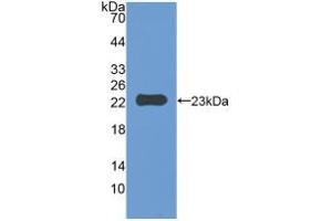 Western blot analysis of recombinant Mouse IAP. (CD47 抗体  (AA 18-219))