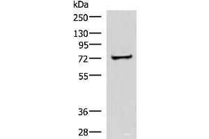 Western blot analysis of Human liver tissue lysate using ZNF263 Polyclonal Antibody at dilution of 1:500 (ZNF263 抗体)