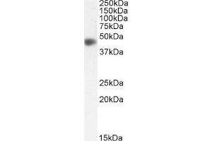 Western Blotting (WB) image for anti-Actin, alpha 2, Smooth Muscle, Aorta (ACTA2) (N-Term) antibody (ABIN185271)
