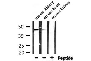 Western blot analysis of extracts from mouse kidney,mouse heart, using SYT13 Antibody. (SYT13 抗体  (Internal Region))