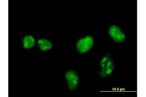 Immunofluorescence of monoclonal antibody to MKNK1 on HeLa cell. (MKNK1 抗体  (AA 1-465))