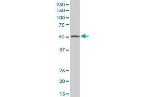 TGFBR1 polyclonal antibody (A01), Lot # ABNOVA060606QCS1 Western Blot analysis of TGFBR1 expression in HepG2 . (TGFBR1 抗体  (AA 30-125))