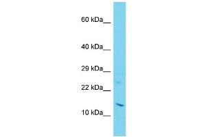 Host: Rabbit Target Name: C11orf1 Sample Type: Jurkat Whole Cell lysates Antibody Dilution: 1. (C11orf1 抗体  (C-Term))