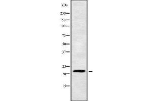 Western blot analysis of CIB4 using MCF7 whole cell lysates (CIB4 抗体  (C-Term))