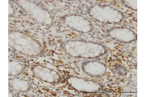 Image no. 3 for anti-Selenophosphate Synthetase 2 (SEPHS2) (AA 61-151) antibody (ABIN599185) (SEPHS2 抗体  (AA 61-151))
