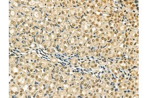 ABIN6259857 and ABIN6266711 at 1/100 staining Mouse brain tissue by IHC-P.