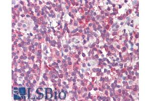 ABIN768655 (5µg/ml) staining of paraffin embedded Human Tonsil. (MTHFD1L 抗体  (AA 535-538))