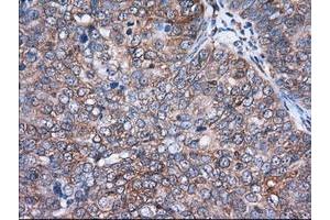 Image no. 1 for anti-Acetyl-CoA Acetyltransferase 2 (ACAT2) antibody (ABIN1496404) (ACAT2 抗体)
