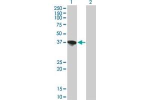 Western Blotting (WB) image for anti-Sorbitol Dehydrogenase (SORD) (AA 1-111) antibody (ABIN599435) (SORD 抗体  (AA 1-111))