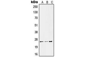 Western blot analysis of Kallikrein 11 expression in HeLa LPS-treated (A), SP2/0 UV-treated (B), PC12 LPS-treated (C) whole cell lysates. (Kallikrein 11 抗体  (Center))