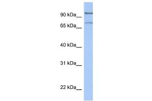 WB Suggested Anti-LCMT2 Antibody Titration:  0. (LCMT2 抗体  (C-Term))