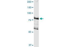 Immunoprecipitation of DGKG transfected lysate using anti-DGKG MaxPab rabbit polyclonal antibody and Protein A Magnetic Bead , and immunoblotted with DGKG purified MaxPab mouse polyclonal antibody (B01P) . (DGKG 抗体  (AA 1-766))