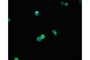 Immunofluorescent analysis of HepG2 cells using ABIN7145646 at dilution of 1:100 and Alexa Fluor 488-congugated AffiniPure Goat Anti-Rabbit IgG(H+L) (DBC1 抗体  (AA 20-320))