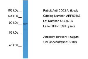 WB Suggested Anti-CD22  Antibody Titration: 0. (CD22 抗体  (N-Term))