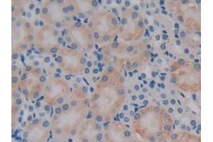 Detection of PDHX in Mouse Kidney Tissue using Polyclonal Antibody to Pyruvate Dehydrogenase Complex Component X (PDHX) (PDHX 抗体  (AA 222-471))
