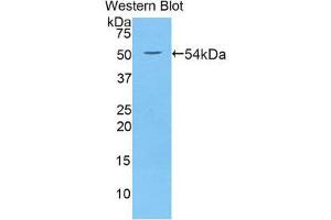 Western Blotting (WB) image for anti-Wingless-Type MMTV Integration Site Family, Member 10A (WNT10A) (AA 108-343) antibody (ABIN3202078) (WNT10A 抗体  (AA 108-343))