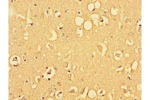 Immunohistochemistry of paraffin-embedded human brain tissue using ABIN7153215 at dilution of 1:100 (ALDOC 抗体  (AA 190-354))