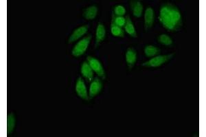 Immunofluorescent analysis of A549 cells using ABIN7159096 at dilution of 1:100 and Alexa Fluor 488-congugated AffiniPure Goat Anti-Rabbit IgG(H+L) (MDC1 抗体  (AA 1892-2082))