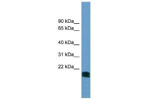 NT5M antibody used at 1 ug/ml to detect target protein. (NT5M 抗体  (N-Term))