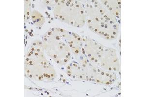 Immunohistochemistry of paraffin-embedded human stomach using HNRNPA1 Antibody (ABIN5975570) at dilution of 1/100 (40x lens). (HNRNPA1 抗体)