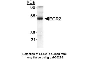 Image no. 1 for anti-Early Growth Response 2 (EGR2) (AA 200-300) antibody (ABIN363607) (EGR2 抗体  (AA 200-300))