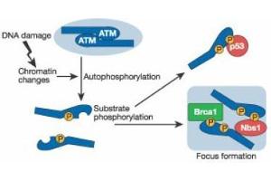 Image no. 2 for anti-Ataxia Telangiectasia Mutated (ATM) (pSer1981) antibody (ABIN401482) (ATM 抗体  (pSer1981))
