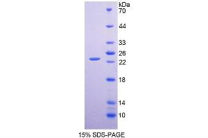 SDS-PAGE (SDS) image for CXADR-Like Membrane Protein (CLMP) (AA 19-183) protein (His tag) (ABIN6237676)
