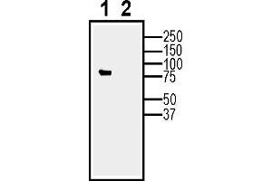 Expression of Calnexin in  cells (lane 1) and in -derived exosomes (lane 2).