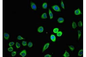 Immunofluorescent analysis of A549 cells using ABIN7164562 at dilution of 1:100 and Alexa Fluor 488-congugated AffiniPure Goat Anti-Rabbit IgG(H+L) (ZDHHC1 抗体  (AA 283-389))